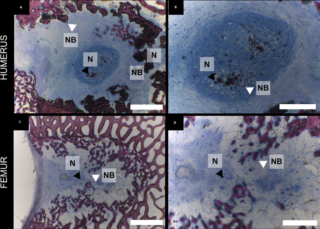 Histology: new bone NB in contact with nacre N in a sheep model at eight weeks