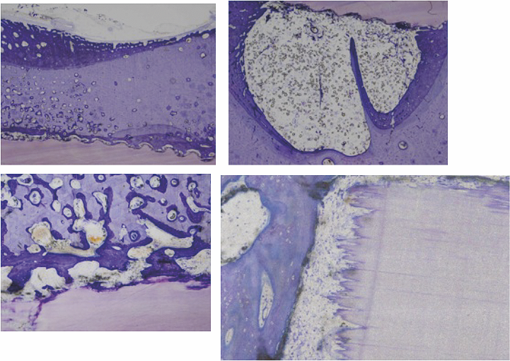 Planche Osteomim Process : quatre vues histologiques de tissus au microscope.